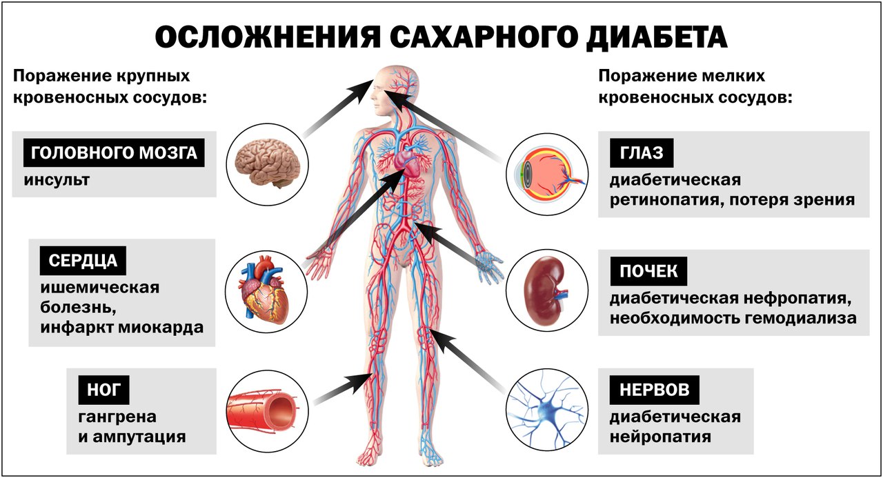 Развитие диабета